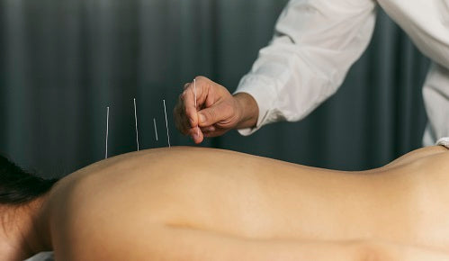 ¿Cómo ayuda la acupuntura en la salud hormonal?